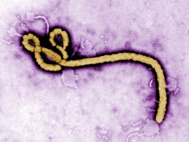 Ebola sa v Kongu rýchlo šíri, zasiahla aj miliónové mesto