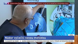 Unikátna operácia nádoru mladíka vyliečila, bola prvou na Slovensku