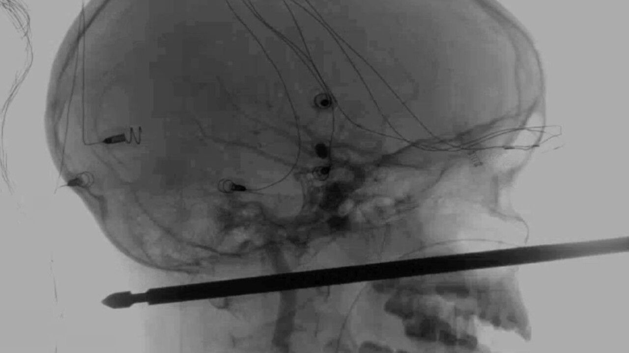 Lekári hovoria o zázraku. Chlapec prežil hororové zranenie