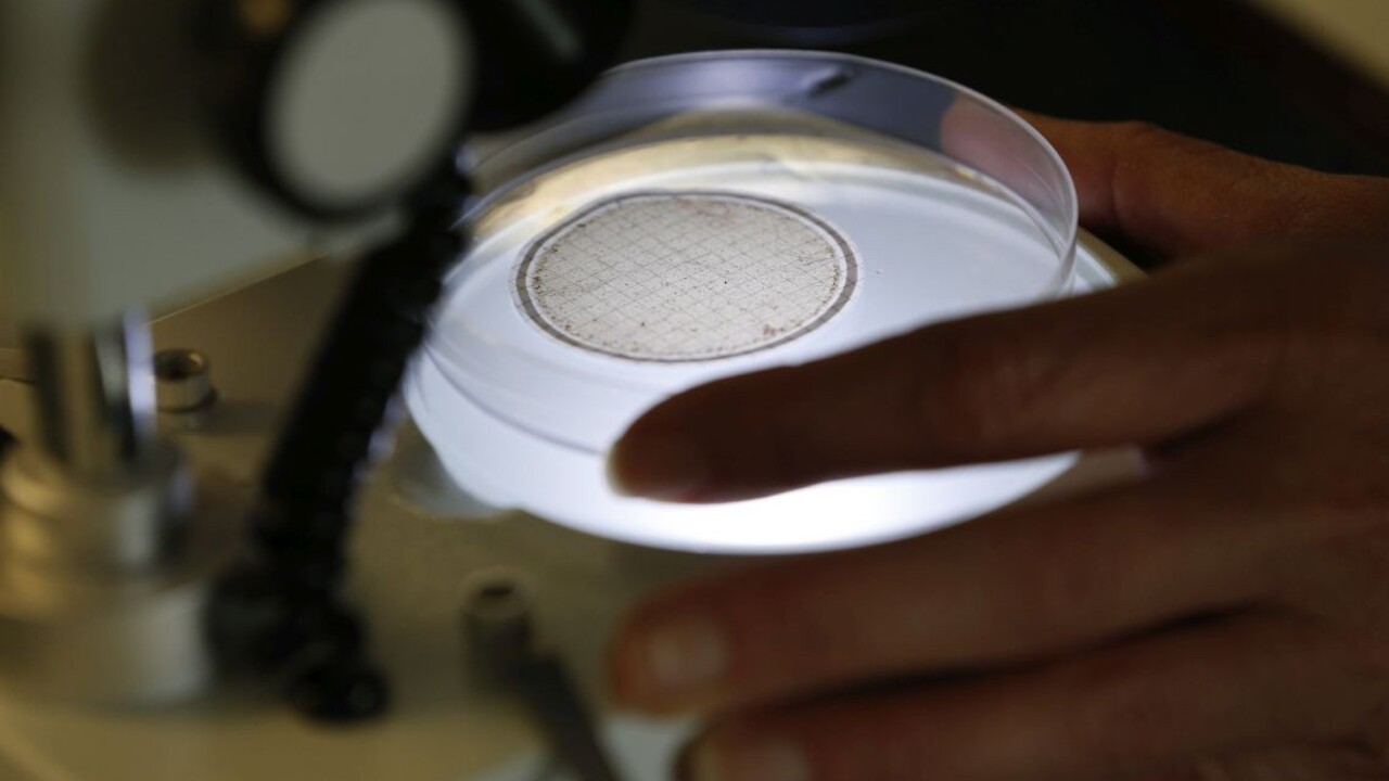 veda mikroskop vedci chémia pokus biológia 1140px (SITA/AP)