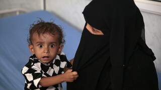V Jemene každých 10 minút zomrie dieťa, ľudia nemajú čo jesť