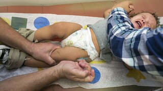 Stúpol počet nakazených osýpkami v Trebišovskom okrese