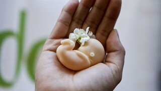 Smer chystá sprísnenie potratov, podľa premiéra ho nebude presadzovať