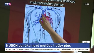 NÚSCH v novej metóde liečby pľúc vloží pacientom do tela pumpu