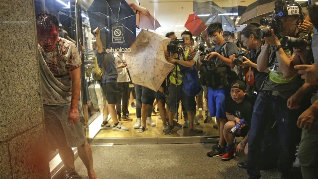Hongkong patrí Číne, kričal ozbrojenec. Politikovi odhryzol ucho