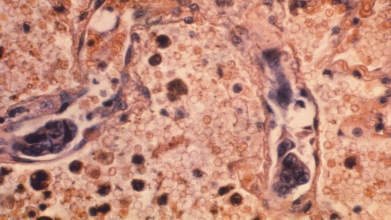 Narazili na krvinku, ktorá môže byť všeliekom proti rakovine