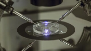 Macron plní sľub, oplodnenie môžu využiť i lesby a slobodné ženy