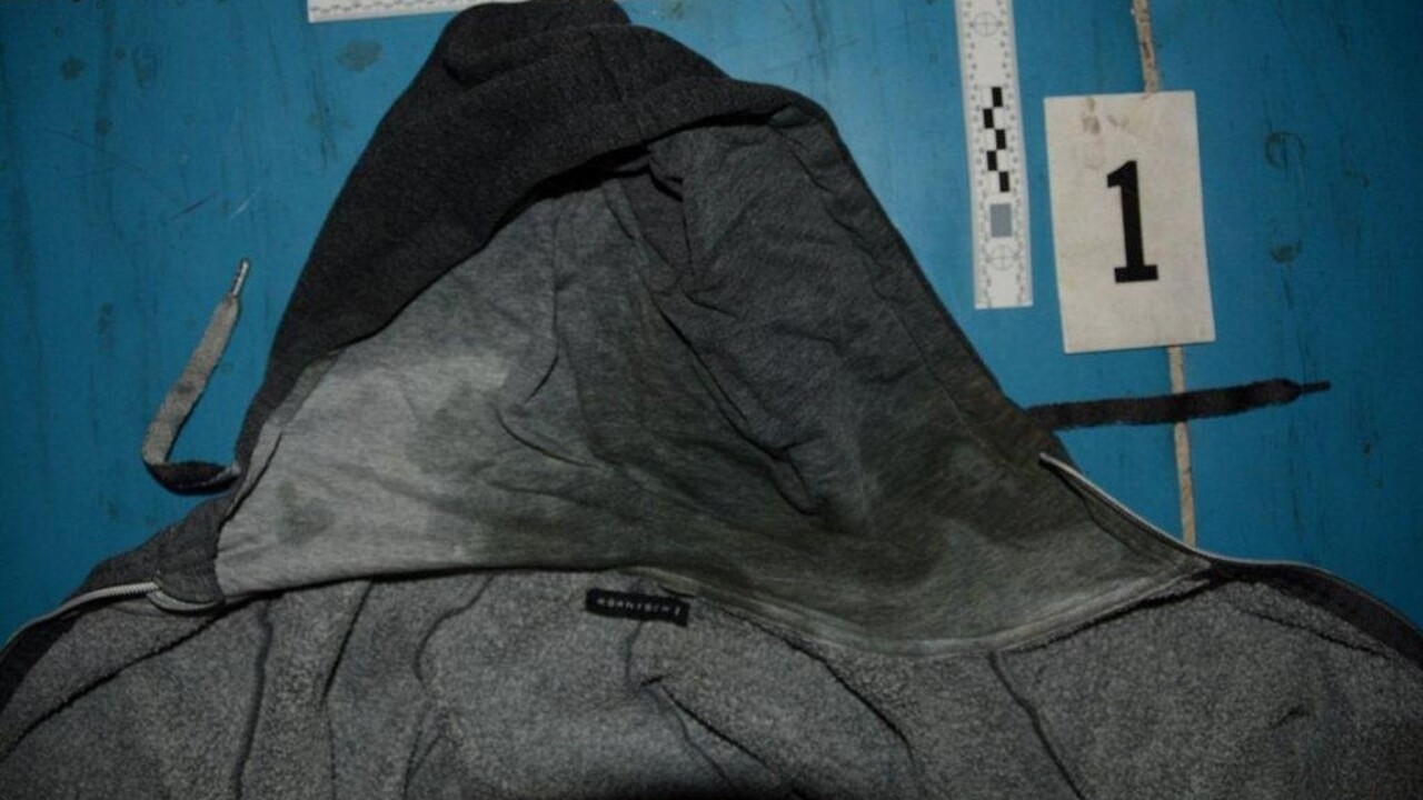 Muž beštiálne zaútočil na bývalú manželku. Polial ju kyselinou