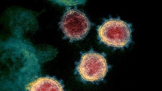 „Skrytý prenos“ môže za rýchle šírenie koronavírusu v ohnisku nákazy