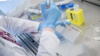 Súkromné laboratóriá samoplatiteľov testovať nebudú