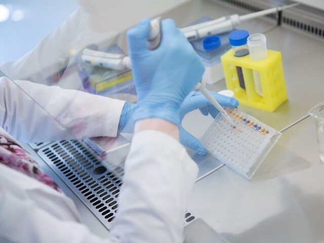 Súkromné laboratóriá samoplatiteľov testovať nebudú