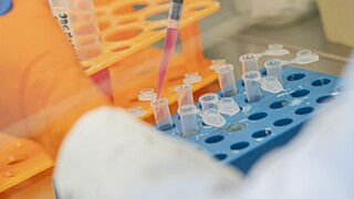 Testovať už budú aj v Trenčíne, plánujú vyšetriť sto vzoriek denne