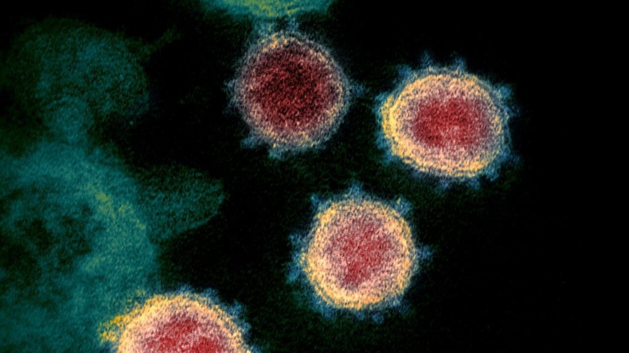 Desaťtisíce obetí vírusu? Ide iba o zlomok skutočných počtov