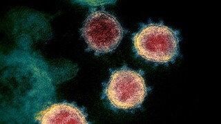 Desaťtisíce obetí vírusu? Ide iba o zlomok skutočných počtov