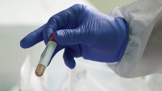 Testovali desiatky zdravotníkov v izolácii, nákazu zistili u upratovačky