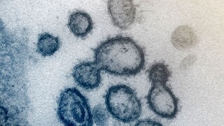 Koľko a kde je v SR najviac nakazených? Zverejnili štatistiky