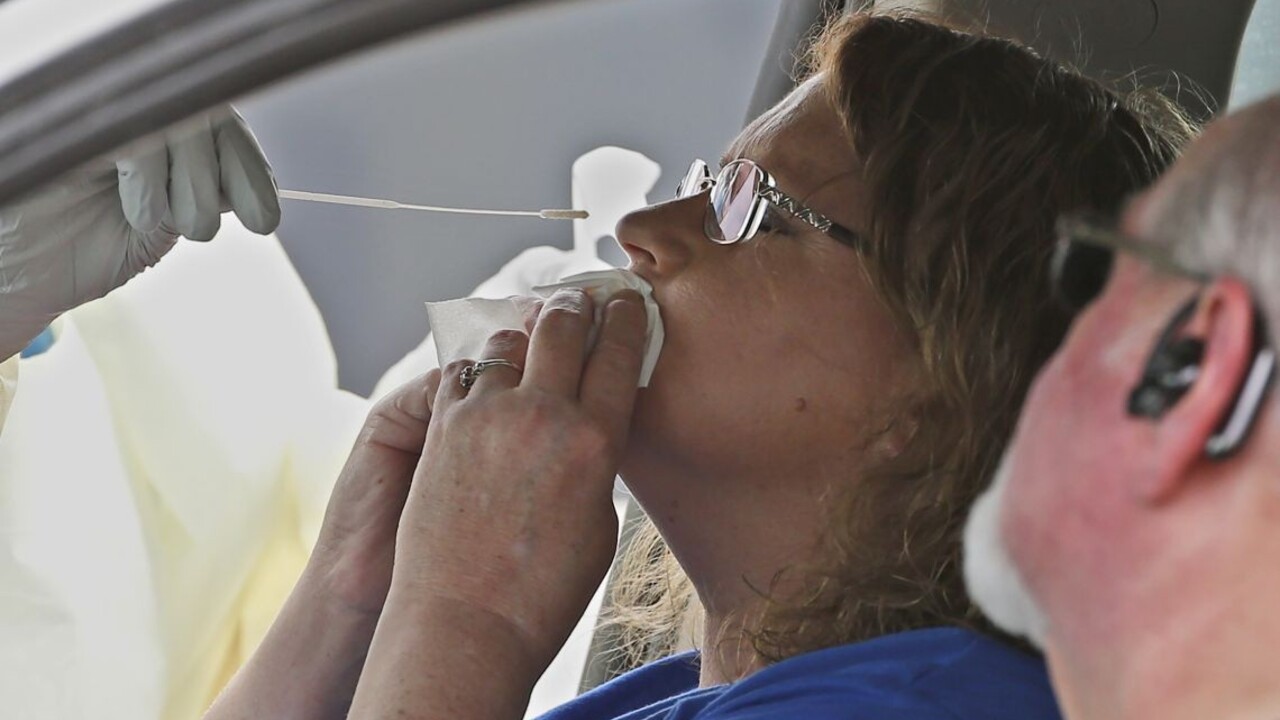 Idete sa dať otestovať na koronavírus? Toto potrebujete vedieť