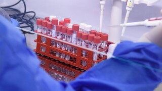 V martinskom centre sociálnych služieb čakajú na výsledky testovania