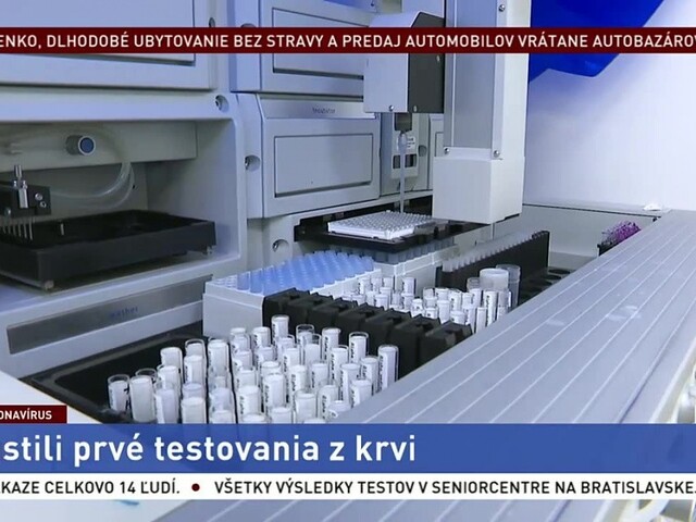 Spustili testovanie z krvi, vzorky odobrali prvým pacientom