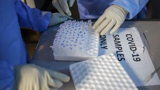 Známy infektológ hovoril o pôvode vírusu, nesúhlasí s Trumpom