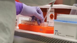 EÚ chce vyšetriť pôvod koronavírusu, návrh podporila Austrália