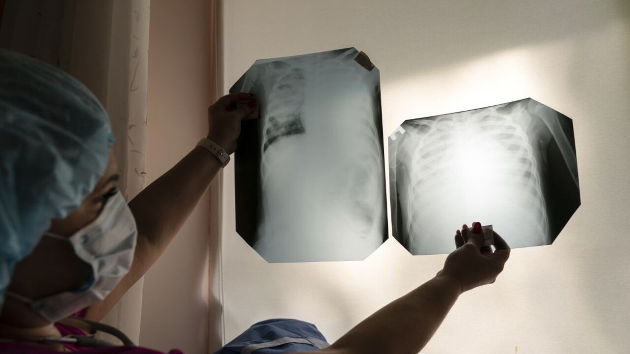 Máme vlastný test na koronavírus. Pribudli nakazení, nik nezomrel