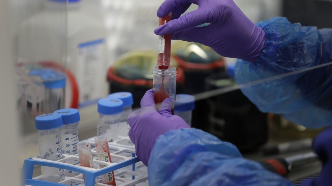 Vírus unikol z laboratórií? Výmysly, tvrdí riaditeľka ústavu v Číne