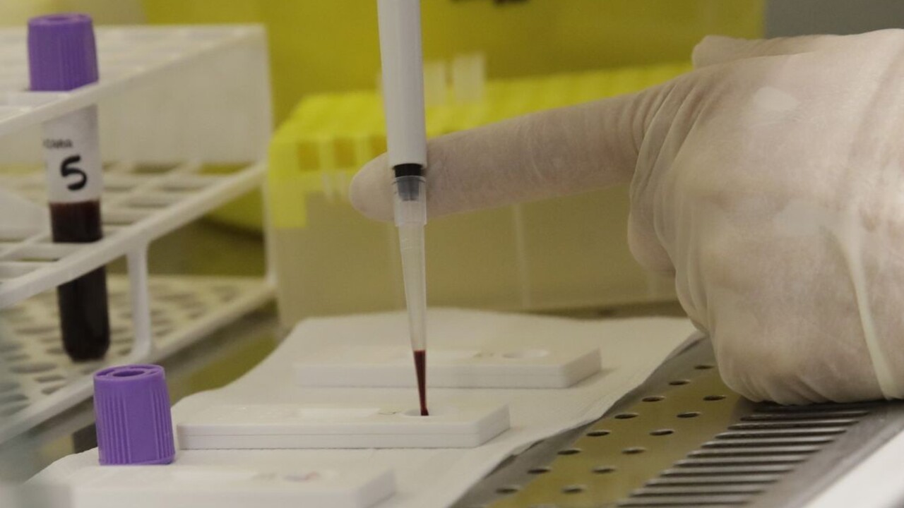 Nechcite od Slovákov testy, žiada susedné štáty šéf diplomacie