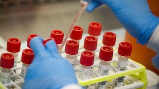 Slovensko podporí výskum koronavírusu, vláda vyčlenila milióny