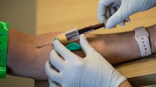 V Čadci majú desiatky prípadov, podľa hygieničky budú pribúdať