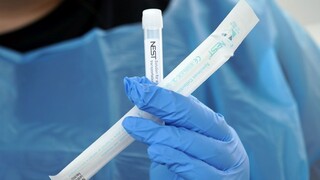 Sestra z nemocnice má COVID-19, testovali desiatky pracovníkov