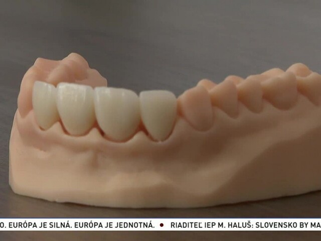 Technológie v zubárstve / Príjemnejšie testovanie na COVID-19 / Ruiny aztéckeho paláca