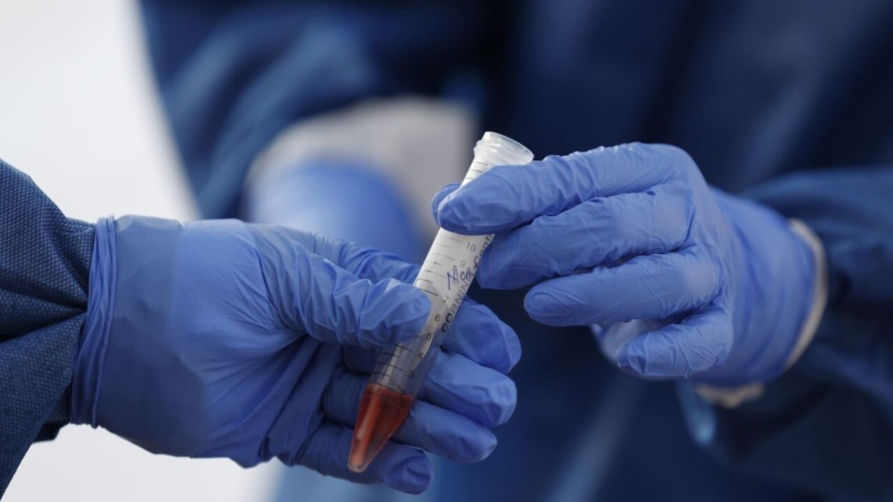 Pribudli ďalšie desiatky prípadov, najviac v hlavnom meste