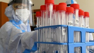 Slováci majú väčší záujem o testovanie, ide najmä o jednu skupinu