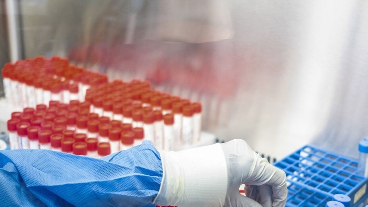 Poznajú počet nakazených. Vírus podľa Fekollini prišiel od dodávateľa