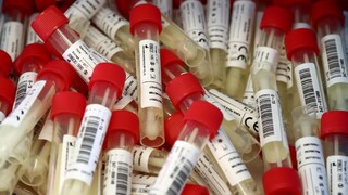 Sme pripravení na druhú vlnu? Názory odborníkov sa líšia