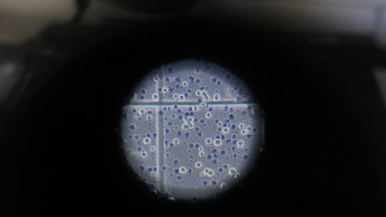Poklad v materskom mlieku. Vedci objavili protilátky proti nákaze