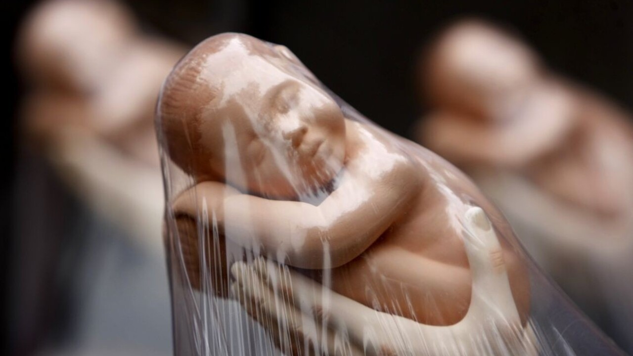 Rezort odporúča schváliť zmeny interrupcií, má však pripomienky