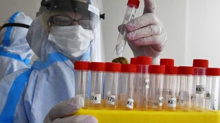 Nové prípady potvrdili aj v ZSS, nakazili sa klienti i personál