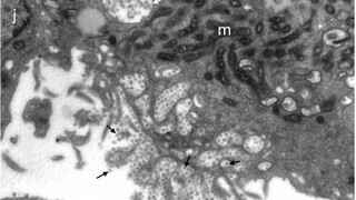 Ukázali, ako vyzerá koronavírus od slovenských pacientov