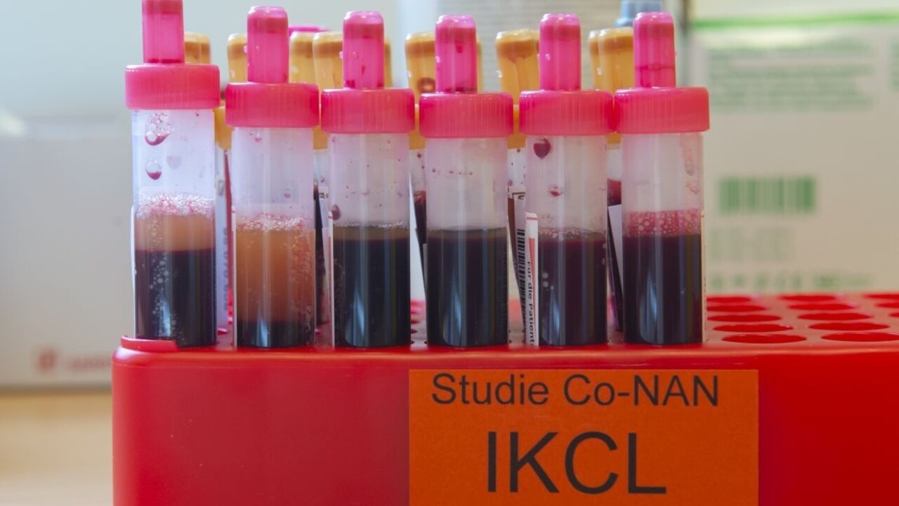 Získali vysoko účinnú zbraň proti nákaze, vie ihneď ochrániť