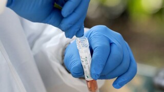 V bratislavskom DSS odhalili nové prípady, platia prísne opatrenia