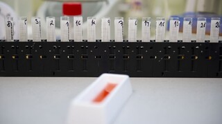 Začali používať antigénové testy, výsledok zistia do 20 minút