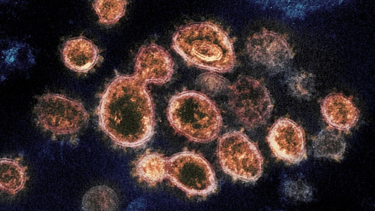Zistili, aké množstvo vírusu musí napadnúť telo, aby ochorelo