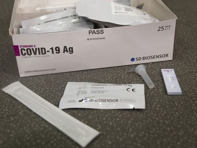 Máme inú možnosť? Prezradili, kvôli komu treba plošne testovať