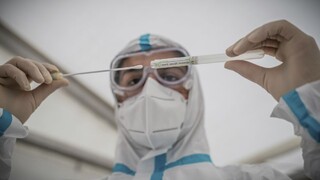 Testovaniu má predchádzať štúdia, vedcovi chýbajú informácie