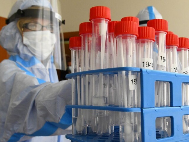 Prípravy na víkendové testovanie vrcholia, mnohí sa obávajú