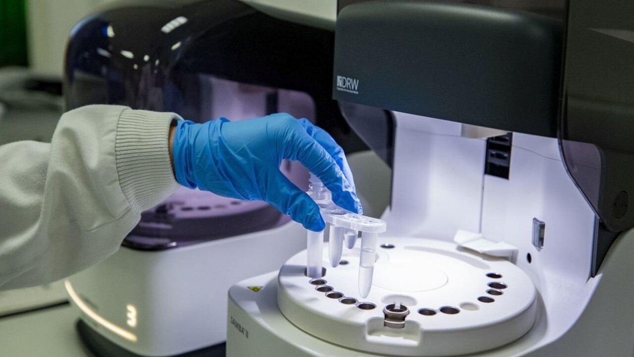 Schválili nový liek proti nákaze, pomôže už po jednej infúzii