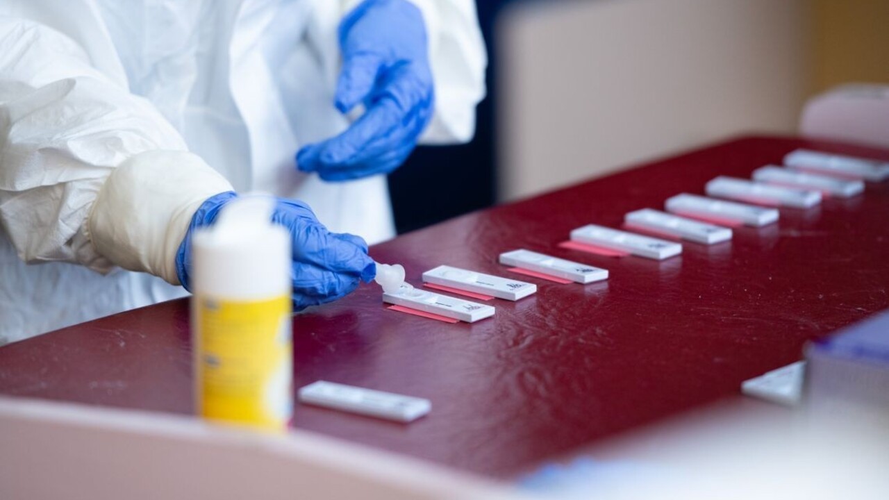 Spustili obstarávanie testov. Štát potrebuje milióny a rýchlo