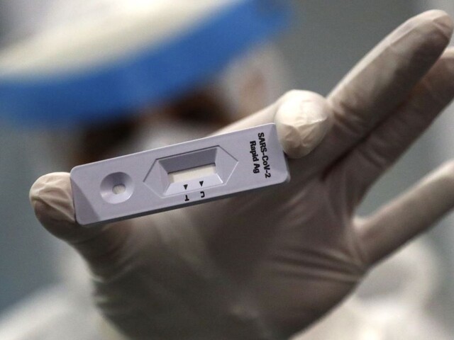 Slovensko očakáva lietadlo plné testov. Kupujeme ich po päť eur
